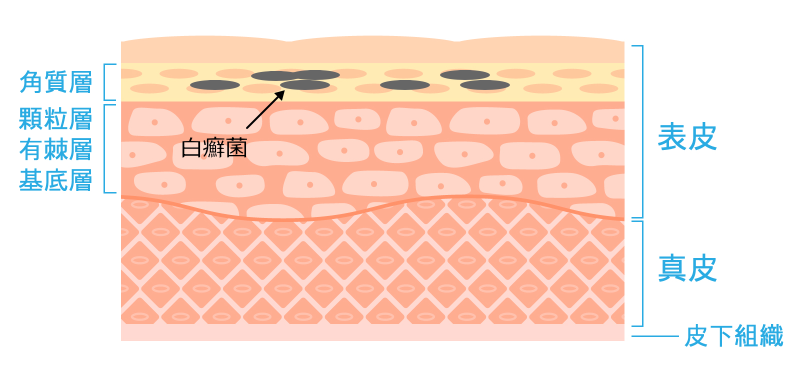 皮膚の構造と白癬菌